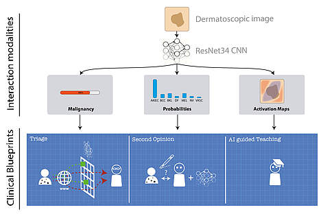  Study illustrates huge potential of human/Artificial Intelligence collaboration in medicine