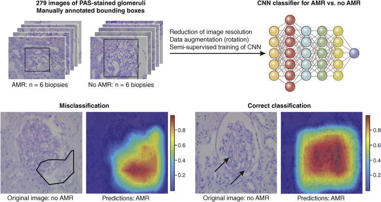  Artificial intelligence and machine learning in nephropathology